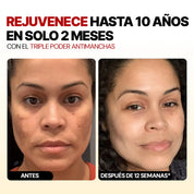 Combo Renovación a los 30+