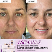 Combo Renovación e Iluminación